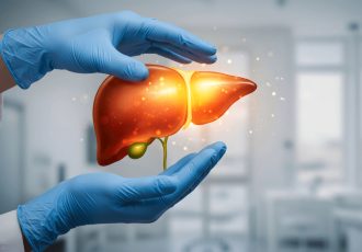 کبد چرب؛ آزمایشها و رژیم غذایی کبد چرب؛ آزمایشها و رژیم غذایی