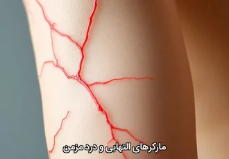 مارکرهای التهابی و درد مزمن مارکرهای التهابی و درد مزمن